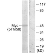 Rabbit anti-Myc (Phospho-Thr58) polyclonal antibody