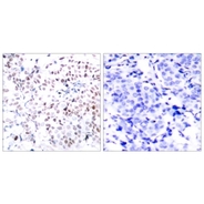 Rabbit anti-Myc (Phospho-Thr358) polyclonal antibody