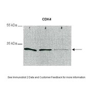 Rabbit anti-CDK4 polyclonal antibody - C-terminal region