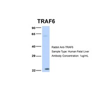 Rabbit anti-TRAF6 polyclonal antibody - middle region