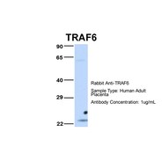 Rabbit anti-TRAF6 polyclonal antibody - middle region