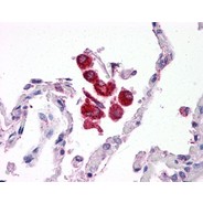 Rabbit anti-TLR2 polyclonal antibody - C-terminal region