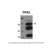 Rabbit anti-TP53 polyclonal antibody - N-terminal region