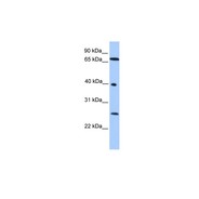 Rabbit anti-L3MBTL2 polyclonal antibody - N-terminal region