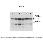 Rabbit anti-RELA polyclonal antibody - middle region