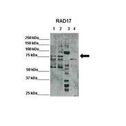 Rabbit anti-RAD17 polyclonal antibody - C-terminal region