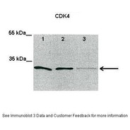 Rabbit anti-CDK4 polyclonal antibody - C-terminal region