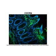 Rabbit anti-CXCR4 polyclonal antibody - N-terminal region