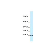 Rabbit anti-Sumo1 polyclonal antibody - N-terminal region