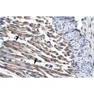 Rabbit anti-JMJD8 polyclonal antibody - middle region
