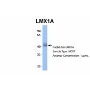 Rabbit anti-LMX1A polyclonal antibody - middle region