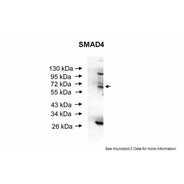 Rabbit anti-SMAD4 polyclonal antibody - middle region