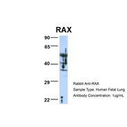 Rabbit anti-RAX polyclonal antibody - N-terminal region