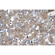 Rabbit anti-ZNF81 polyclonal antibody - middle region