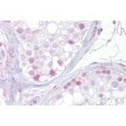 Rabbit anti-NR4A1 polyclonal antibody - N-terminal region