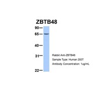 Rabbit anti-ZBTB48 polyclonal antibody - N-terminal region