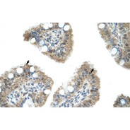 Rabbit anti-NAB1 polyclonal antibody - N-terminal region