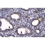 Rabbit anti-HMGB2 polyclonal antibody - C-terminal region