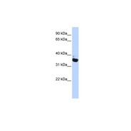 Rabbit anti-OR13C5 polyclonal antibody - N-terminal region