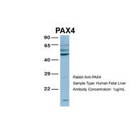 Rabbit anti-PAX4 polyclonal antibody - middle region