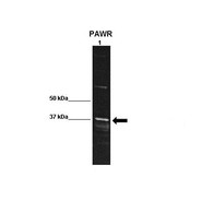 Rabbit anti-PAWR polyclonal antibody - middle region