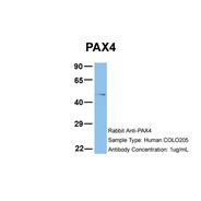 Rabbit anti-PAX4 polyclonal antibody - middle region