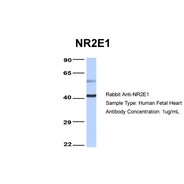 Rabbit anti-NR2E1 polyclonal antibody - N-terminal region