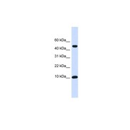 Rabbit anti-ZNF706 polyclonal antibody - N-terminal region