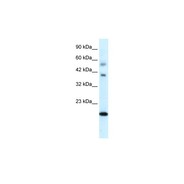 Rabbit anti-CGI-143 polyclonal antibody - N-terminal region