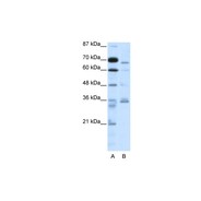 Rabbit anti-PCSK6 polyclonal antibody - N-terminal region