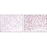 SignalStain ® Boost IHC Detection Reagent (HRP, Mouse)