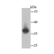 Lactate Dehydrogenase [SU39-06]