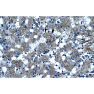 Rabbit anti-SUPT3H polyclonal antibody - N-terminal region