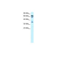 Rabbit anti-ZNF512 polyclonal antibody - middle region