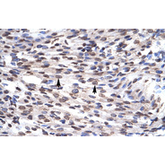 Rabbit anti-GFI1B polyclonal antibody - N-terminal region