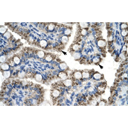 Rabbit anti-C20ORF100 polyclonal antibody - N-terminal region