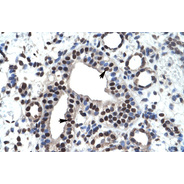 Rabbit anti-ZNF499 polyclonal antibody - middle region