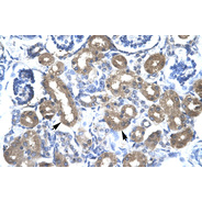 Rabbit anti-CBX4 polyclonal antibody - N-terminal region