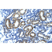 Rabbit anti-FLJ14768 polyclonal antibody - C-terminal region