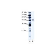 Rabbit anti-ZNF541 polyclonal antibody - middle region