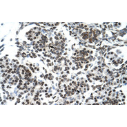 Rabbit anti-ZNF394 polyclonal antibody - N-terminal region