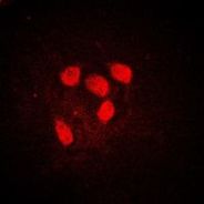 c-Myc (phospho Ser62) antibody