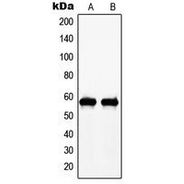 c-Myc (phospho Thr58) antibody