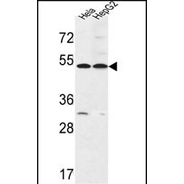FERMT1 antibody, Internal