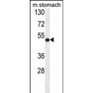 FERMT1 antibody, Internal