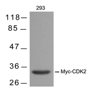 Myc tag antibody 