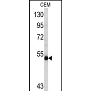 n-Myc antibody, C-term
