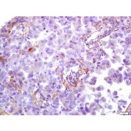 Rabbit Anti-HCMV pp65  antibody