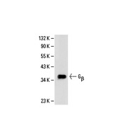 Gβ Antibody (T-20)