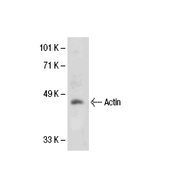 Actin Antibody (H-196) FITC